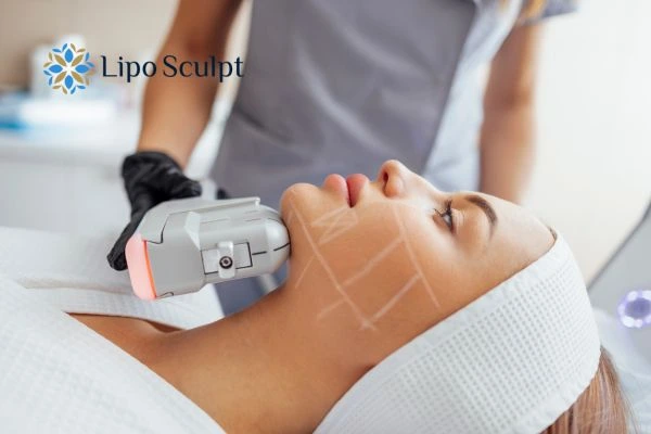 HIFU vs Botulinum Toxin: Understanding the Differences 1 HIFU vs Botox Redbourn What is the best option for you?