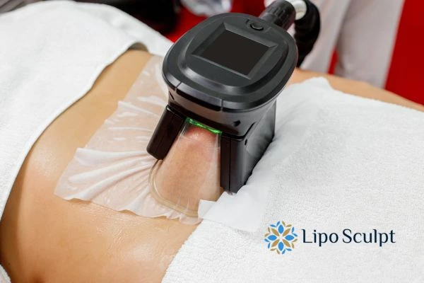 Does Fat Freezing at Home Work? DIY Devices vs Professional Cryolipolysis 1 How is professional cryolipolysis different Redbourn?