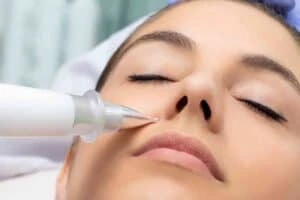 Best Actinic Keratoses Removal 3 Actinic keratoses Redbourn solutions - book in today!