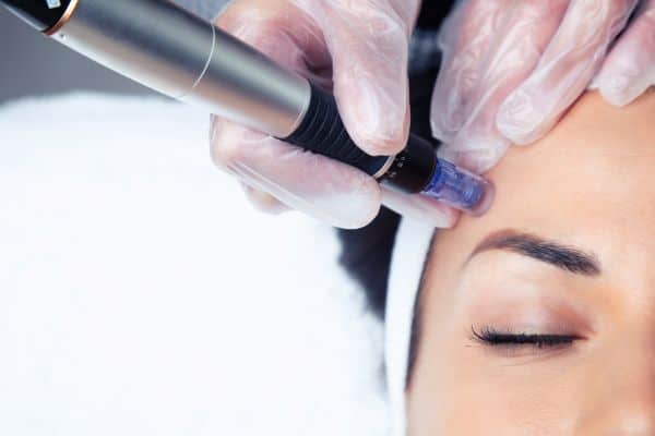 Explaining Total Skin Tightening Treatment and What to Expect 2 What Skin Concerns Can Total Skin Tightening Treatment Help With Redbourn?